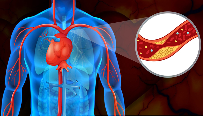 آزمایش HDL چه زمانی انجام می‌شود
