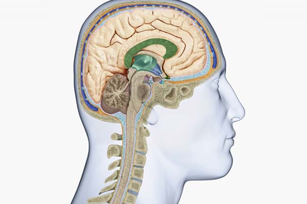 تشخیص بیماری مننژیت