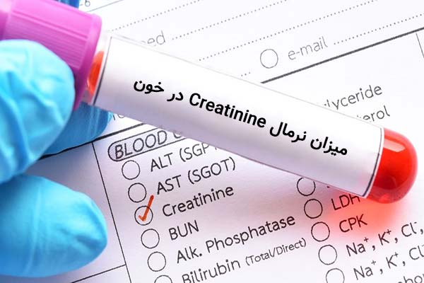 میزان نرمال Creatinine در خون