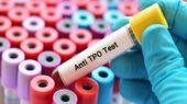 آزمایش Anti TPO چیست
