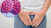 وضعیت شیوع عفونت HPV زنانه در ایران