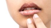 چه بیماری هایی باعث خشکی دهان میشود