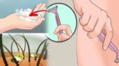 قبل از لیزر بیکینی چه کنیم؟
