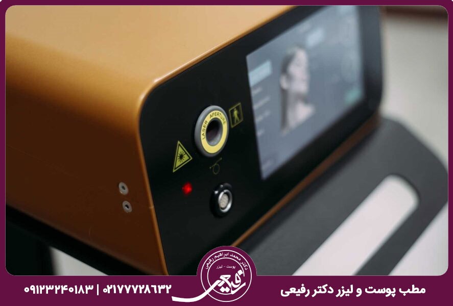 در روش لیزر اندولیفت صورت چه انتظاری داشته باشید؟