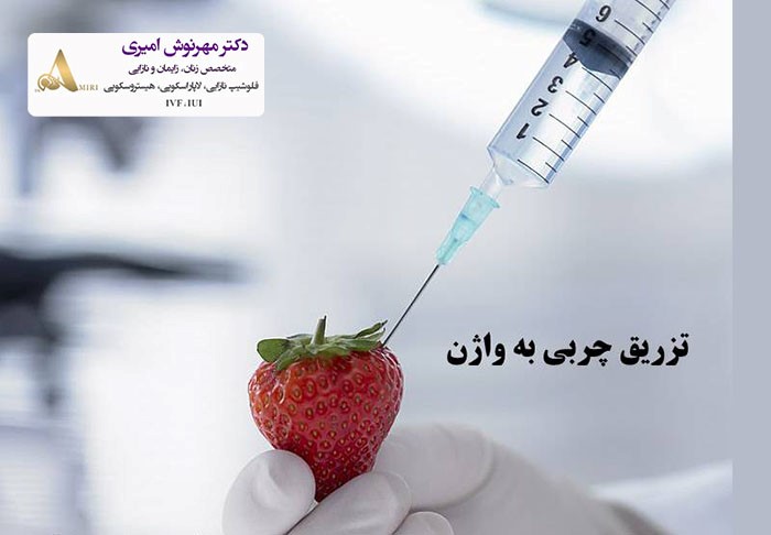 ماندگاری تزریق چربی به واژن چه قدر است