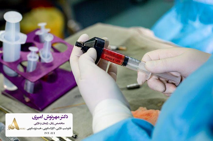 ماندگاری تزریق چربی به واژن