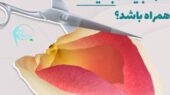 لابیاپلاستی بدون درد و بخیه
