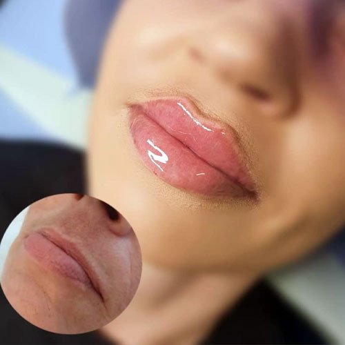 ژل لب روسی چیست ؟