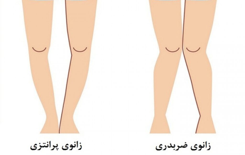 زانوی ضربدری