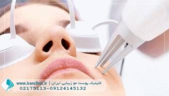 لیزر جای جوش کلینیک زیبایی ایران