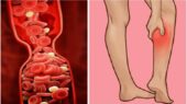 بدن انسان چگونه می‌تواند جلوی خونریزی را بگیرد ؟