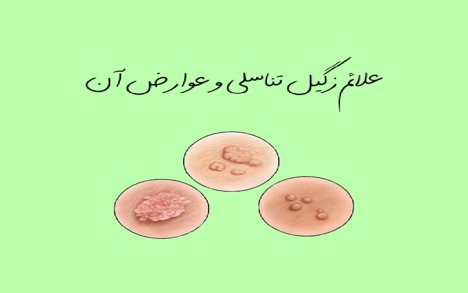 تست hpv