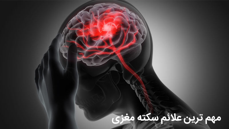 علائم سکته مغزی چیست
