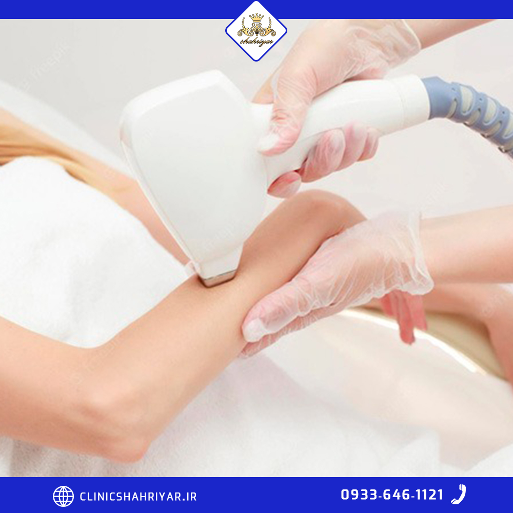 هزینه یا قیمت کاشت ابرو در شهریار