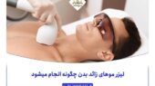 لیزر موهای زائد بدن چگونه انجام میشود