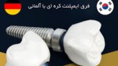بررسی فرق ایمپلنت کره ای با آلمانی