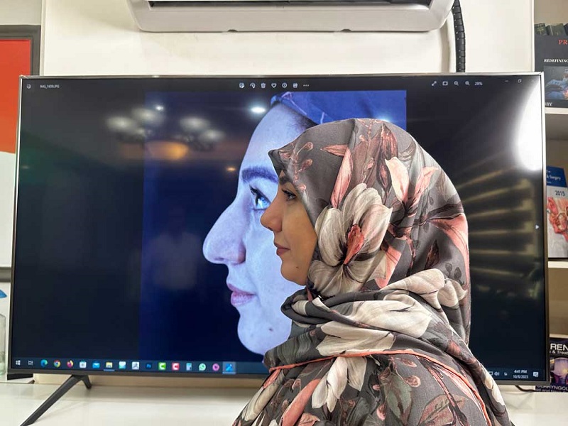 عمل بینی استخوانی برای چه کسانی مناسب نیست