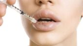 ورم بعد از تزریق ژل لب چند روز طول میکشد