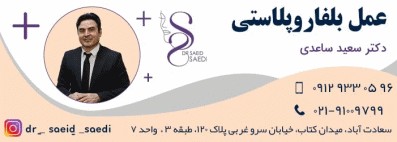 مزایا عمل بلفاروپلاستی