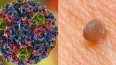 تأیید اولین کیت خودآزمایی HPV توسط FDA