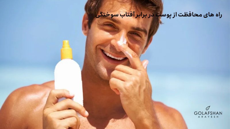 راه های محافظت از پوست در برابر آفتاب سوختگی