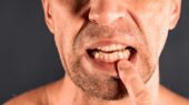 ارتباط دیابت با بیماری‌های لثه