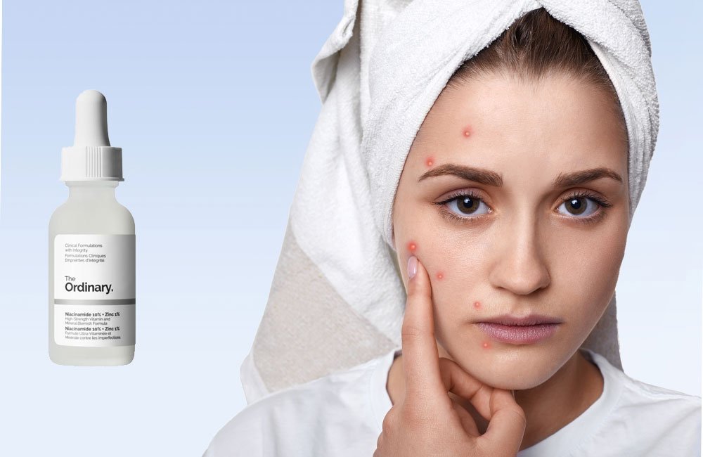 ویژگی های سرم نیاسینامید اوردینری