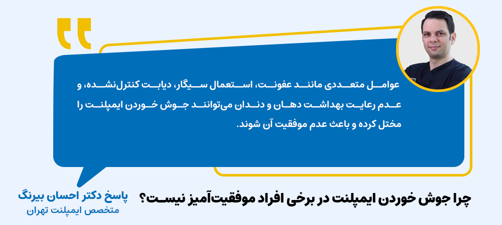 مدت زمان جوش خوردن ایمپلنت در چه کسانی بیشتر طول می کشد؟