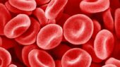 بیماری فاویسم چیست؟ علل، علائم و درمان