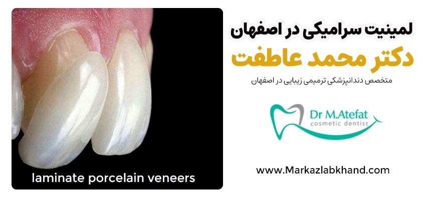 لمینت سرامیکی در اصفهان