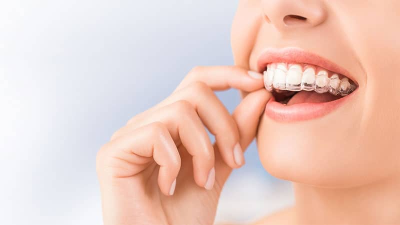 کدام گزینه مقرون به صرفهتر است؟