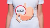 سرطان معده؛ علل، علائم اولیه و راه‌ های پیشگیری از آن