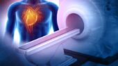 اسکن MRI می‌ تواند بیماری‌ های قلبی را تا 10 سال زودتر شناسایی کند