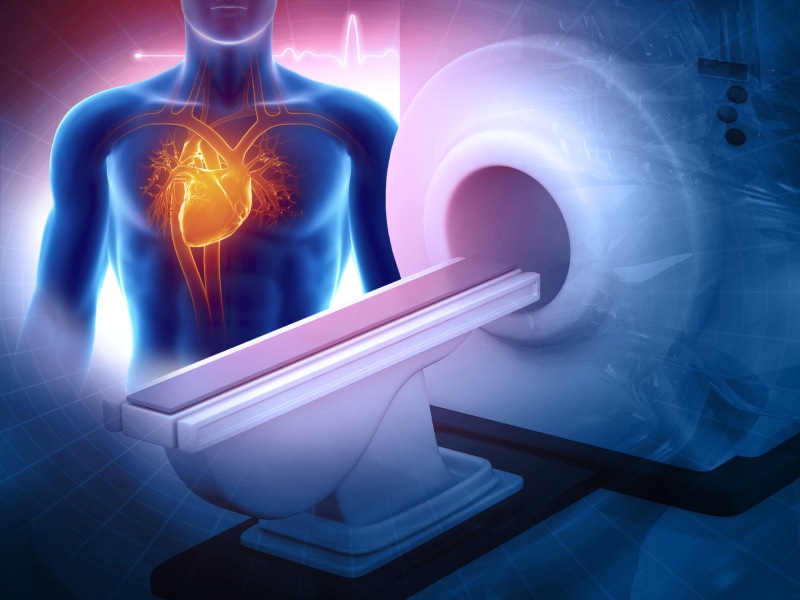اسکن MRI می‌ تواند بیماری‌ های قلبی را تا 10 سال زودتر شناسایی کند