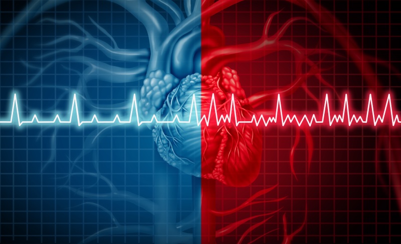 فیبریلاسیون دهلیزی (AFib) چیست؟ راهکارهای مدیریت اختلال ریتم قلب