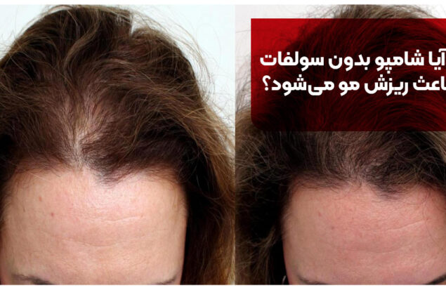 آیا شامپو بدون سولفات باعث ریزش مو میشود