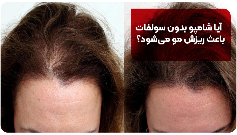 آیا شامپو بدون سولفات باعث ریزش مو میشود