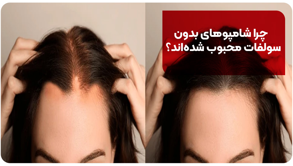 چرا شامپوهای بدون سولفات محبوب شده‌اند؟ 