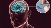 ابتکار دانشمندان MIT: درمان بیماری های مغزی بدون جراحی با تزریق ریز تراشه به بدن