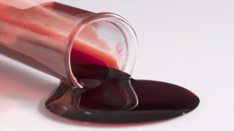 روش‌ های طبیعی برای کاهش غلظت خون با طب سنتی