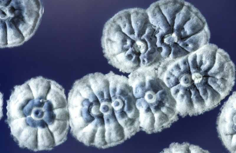 کشف آنتی‌ بیوتیک خاکی جدید که با مقاوم‌ ترین باکتری‌ ها مقابله می‌ کند