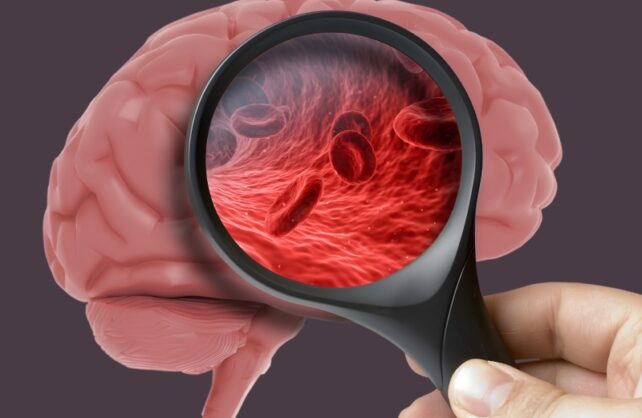 امید تازه برای درمان آلزایمر و زوال عقل با تنظیم یک پروتئین حساس به فشار خون