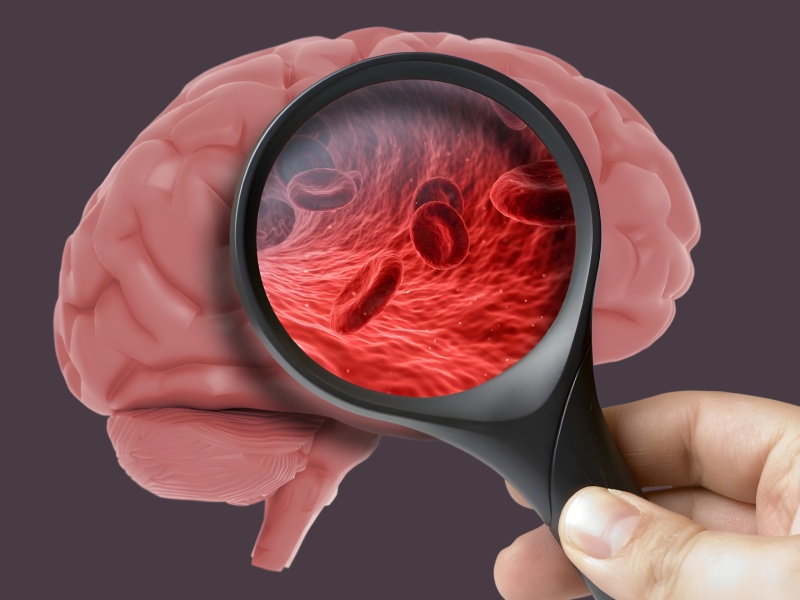 امید تازه برای درمان آلزایمر و زوال عقل با تنظیم یک پروتئین حساس به فشار خون