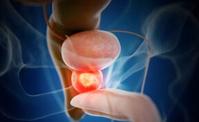 ترکیب دارویی نوین و هورمون‌ درمانی: کاهش بیش از ۴۰ درصدی مرگ ناشی از سرطان پروستات تهاجمی