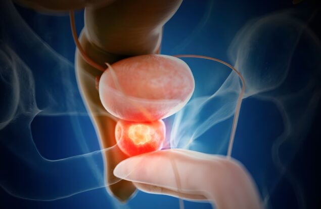 ترکیب دارویی نوین و هورمون‌ درمانی: کاهش بیش از ۴۰ درصدی مرگ ناشی از سرطان پروستات تهاجمی