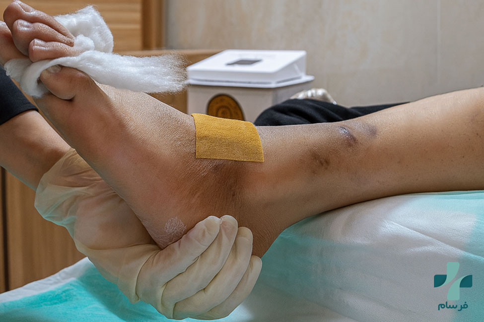 در کلینیک زخم فرسام چه کارهایی برای بیماران دیابتی انجام می‌شود؟