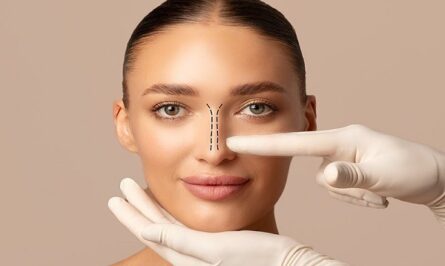 محبوب‌ترین مدل‌های بینی در سال 2026 که جراحان توصیه می‌کنند!