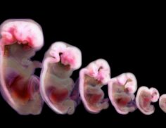 ضرورت ید برای رشد مغز کودکان و پیشگیری از اختلالات تیروئیدی