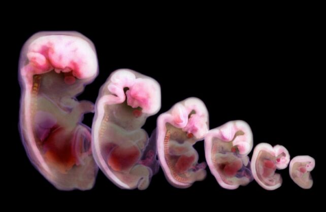 ضرورت ید برای رشد مغز کودکان و پیشگیری از اختلالات تیروئیدی