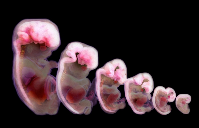 ضرورت ید برای رشد مغز کودکان و پیشگیری از اختلالات تیروئیدی